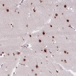 ZNF672 Antibody, Novus Biologicals 25 &mu;L | Buy Online | Novus Biologicals | Fisher Scientific