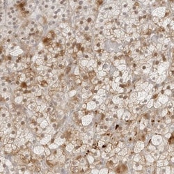 ZNF678 Antibody, Novus Biologicals:Antibodies:Primary Antibodies