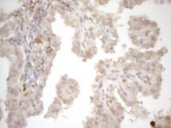 ZNF69 Antibody (OTI3C3), Novus Biologicals 0.1mL; Unlabeled:Antibodies,