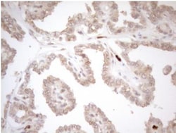 ZNF69 Antibody (OTI3C3), Novus Biologicals 0.1mL; Unlabeled:Antibodies,