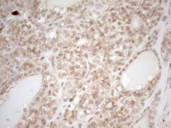ZNF69 Antibody (OTI3C3), Novus Biologicals 0.1mL; Unlabeled:Antibodies,