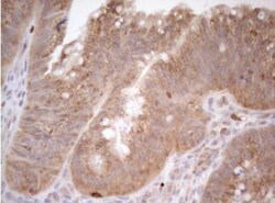 ZNF69 Antibody (OTI3C3), Novus Biologicals 0.1mL; Unlabeled:Antibodies,