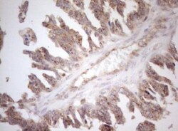 ZNF69 Antibody (OTI3C3), Novus Biologicals 0.1mL; Unlabeled:Antibodies,