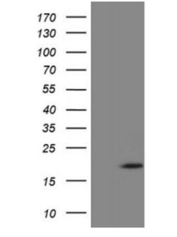 ZNF69 Antibody (OTI3C3), Novus Biologicals 0.1mL; Unlabeled:Antibodies,