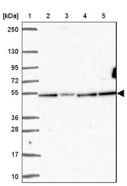 ZNF692 Antibody, Novus Biologicals:Antibodies:Primary Antibodies