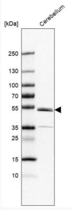 ZNF692 Antibody, Novus Biologicals:Antibodies:Primary Antibodies