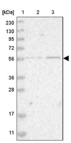 ZNF695 Antibody, Novus Biologicals 0.1 mL | Buy Online | Novus Biologicals | Fisher Scientific