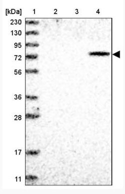 ZNF7 Antibody, Novus Biologicals 25 &mu;L; Unlabeled:Antibodies, Polyclonal