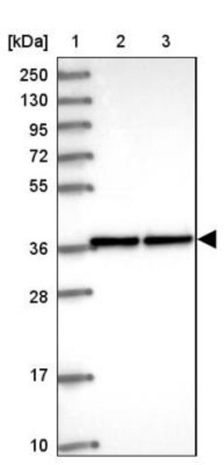 ZNF707 Antibody, Novus Biologicals 25 &mu;L, Unlabeled:Antibodies, Polyclonal