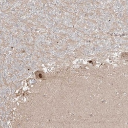 ZNF710 Antibody, Novus Biologicals:Antibodies:Primary Antibodies
