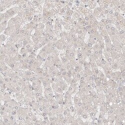 ZNF710 Antibody, Novus Biologicals 25 &mu;L | Buy Online | Novus Biologicals | Fisher Scientific