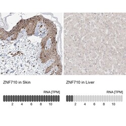 ZNF710 Antibody, Novus Biologicals 25 &mu;L | Buy Online | Novus Biologicals | Fisher Scientific