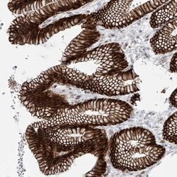 ZNF710 Antibody, Novus Biologicals:Antibodies:Primary Antibodies