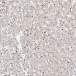 ZNF710 Antibody, Novus Biologicals:Antibodies:Primary Antibodies