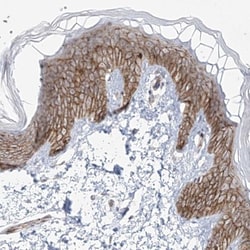 ZNF710 Antibody, Novus Biologicals:Antibodies:Primary Antibodies