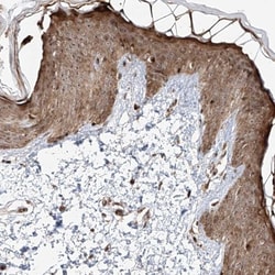 ZNF710 Antibody, Novus Biologicals:Antibodies:Primary Antibodies