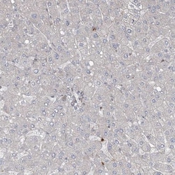 ZNF711 Antibody, Novus Biologicals:Antibodies:Primary Antibodies