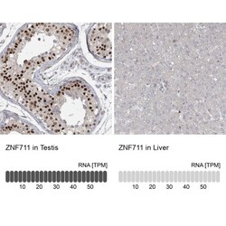 ZNF711 Antibody, Novus Biologicals:Antibodies:Primary Antibodies