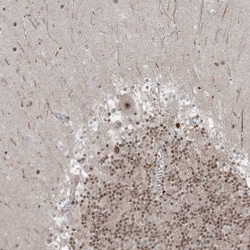 ZNF711 Antibody, Novus Biologicals:Antibodies:Primary Antibodies