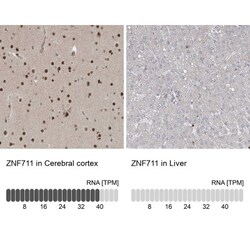ZNF711 Antibody, Novus Biologicals:Antibodies:Primary Antibodies
