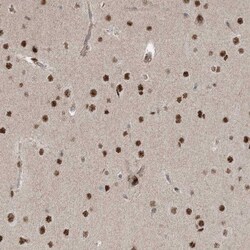 ZNF711 Antibody, Novus Biologicals:Antibodies:Primary Antibodies
