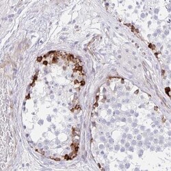 ZNF713 Antibody, Novus Biologicals:Antibodies:Primary Antibodies
