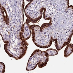 ZNF720 Antibody, Novus Biologicals 25 &mu;L; Unlabeled:Antibodies, Polyclonal