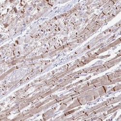 ZNF736 Antibody, Novus Biologicals 0.1mL; Unlabeled:Antibodies, Polyclonal
