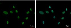 ZNF74 Antibody, Novus Biologicals 0.1mL; Unlabeled:Antibodies, Polyclonal