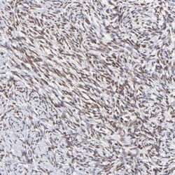 ZNF74 Antibody, Novus Biologicals 25 &mu;L; Unlabeled:Antibodies, Polyclonal