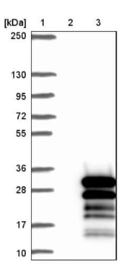 ZNF740 Antibody, Novus Biologicals:Antibodies:Primary Antibodies