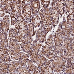 ZNF749 Antibody, Novus Biologicals:Antibodies:Primary Antibodies
