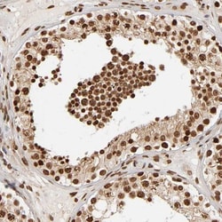 ZNF75 Antibody, Novus Biologicals 0.1mL; Unlabeled:Antibodies, Polyclonal