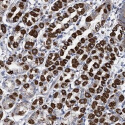 ZNF750 Antibody, Novus Biologicals:Antibodies:Primary Antibodies