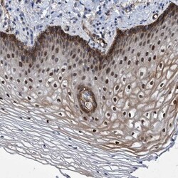 ZNF750 Antibody, Novus Biologicals 0.1mL; Unlabeled:Antibodies, Polyclonal