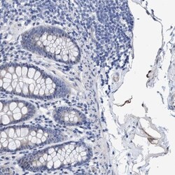 ZNF750 Antibody, Novus Biologicals 0.1mL; Unlabeled:Antibodies, Polyclonal