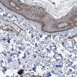 ZNF750 Antibody, Novus Biologicals 0.1mL; Unlabeled:Antibodies, Polyclonal