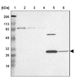 ZNF75A Antibody, Novus Biologicals 25 &mu;L | Buy Online | Novus Biologicals | Fisher Scientific