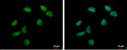 ZNF76 Antibody, Novus Biologicals 0.1mL; Unlabeled:Antibodies, Polyclonal