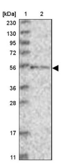 ZNF76 Antibody, Novus Biologicals 0.1mL; Unlabeled:Antibodies, Polyclonal