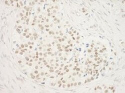 ZNF768 Antibody, Novus Biologicals 0.1mL; Unlabeled:Antibodies, Polyclonal