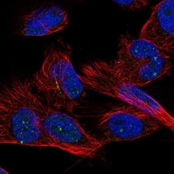 ZNF77 Antibody, Novus Biologicals 0.1mL; Unlabeled:Antibodies, Polyclonal