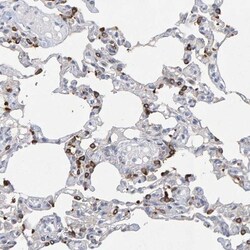ZNF77 Antibody, Novus Biologicals 0.1mL; Unlabeled:Antibodies, Polyclonal
