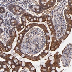 ZNF780B Antibody, Novus Biologicals:Antibodies:Primary Antibodies