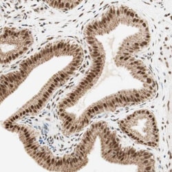 ZNF782 Antibody, Novus Biologicals 0.1mL; Unlabeled:Antibodies, Polyclonal
