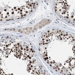 ZNF783 Antibody, Novus Biologicals:Antibodies:Primary Antibodies