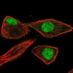 ZNF784 Antibody, Novus Biologicals 0.1mL; Unlabeled:Antibodies, Polyclonal