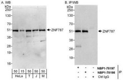 ZNF787 Antibody, Novus Biologicals 0.1mL; Unlabeled:Antibodies, Polyclonal