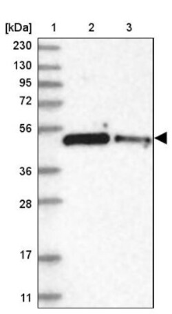 ZNF787 Antibody, Novus Biologicals:Antibodies:Primary Antibodies