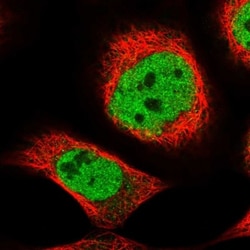 ZNF789 Antibody, Novus Biologicals 0.1mL; Unlabeled:Antibodies, Polyclonal